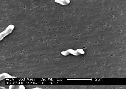 campylobacter photo campylobacter photo